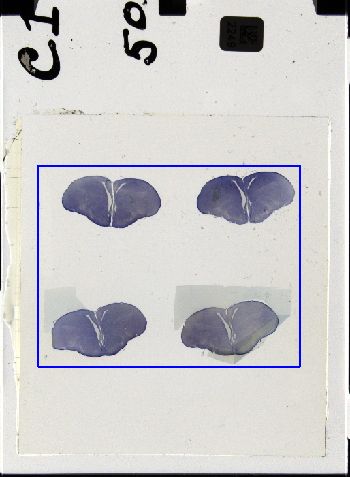Media type: image; Special Collections 3298   shows specimen_part histological serial section;